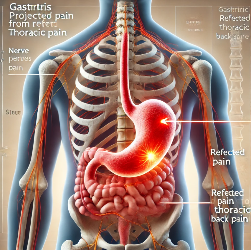 Ejercicio terapéutico para malestar en la espalda media en fisioterapia