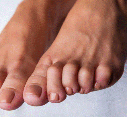 acortamiento del tendón de Aquiles