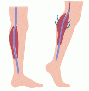 Músculo sóleo y retorno venoso
