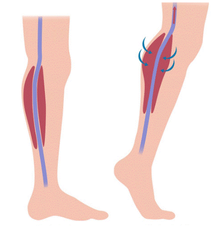 Músculo sóleo y retorno venoso
