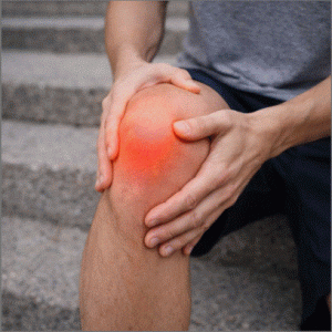 condromalacia rotuliana