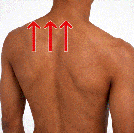 síndrome de la escápula en resorte