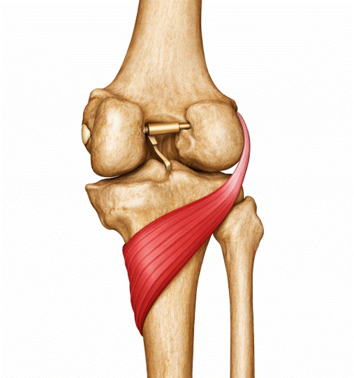 tendinopatía del poplíteo