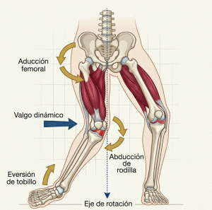 valgus dinámico de rodilla