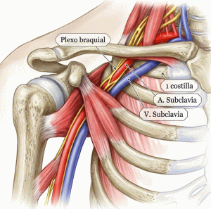 síndrome del pectoral menor