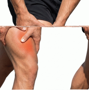 lesión del recto femoral